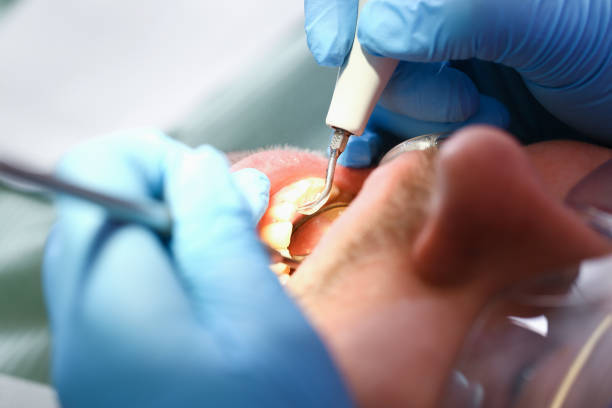 Best Emergency Treatment for Oral Infections in Womelsdorf, PA