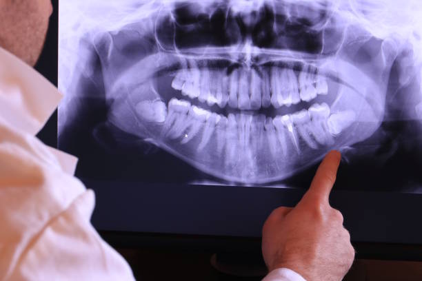 Best Emergency Treatment for Jaw Pain or Injury in Womelsdorf, PA